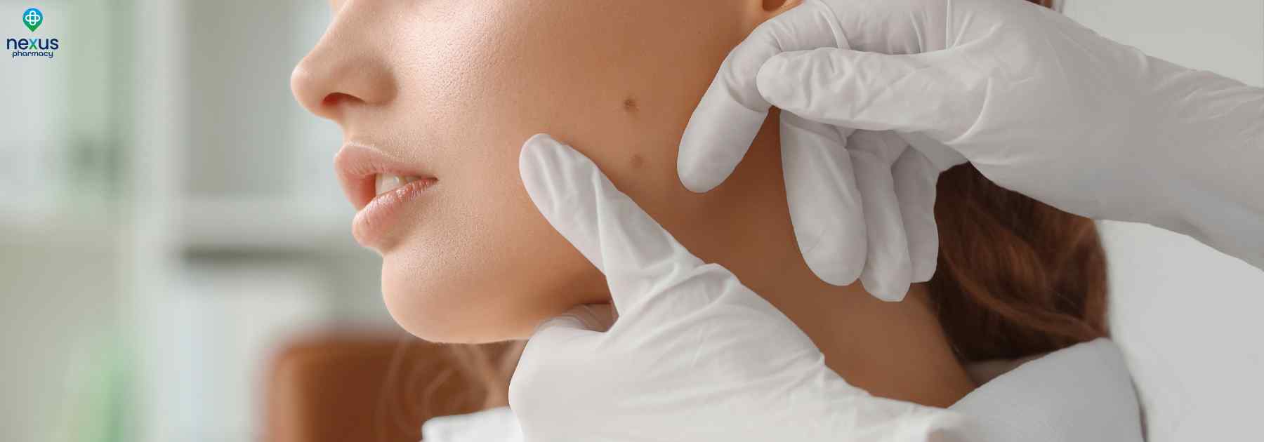 skin tag removal nottingham